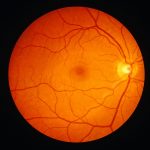 Best 5 ways for retinal photography