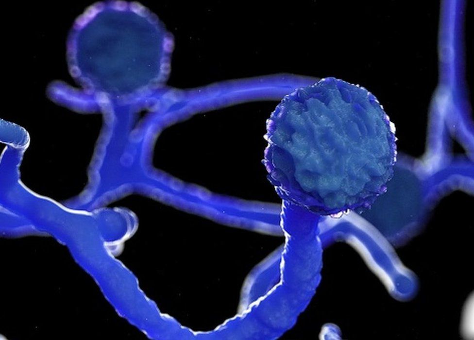 MUCORMYCOSIS