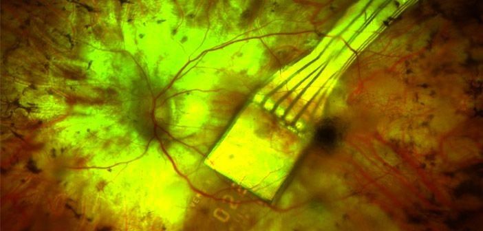 Retinal implants