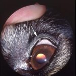 Meibomian Gland Adenoma