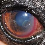 Stromal Corneal Ulcers