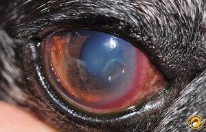 Stromal Corneal Ulcers