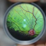 Progressive Retinal Atrophy