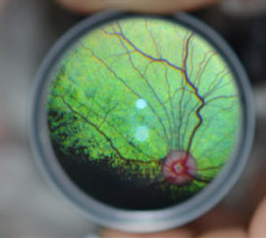 Progressive Retinal Atrophy (PRA): All you need to know