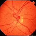 Venous Loop