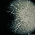 Retinal Vascular Tortuosity