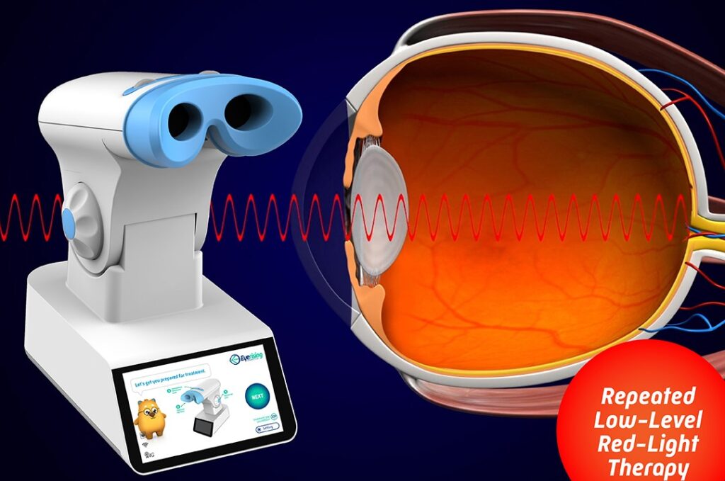 Repeated Low-Level Red-Light (RLRL) therapy