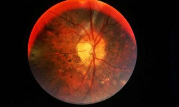 VKH Disease: What Modern Imaging Has Taught Us