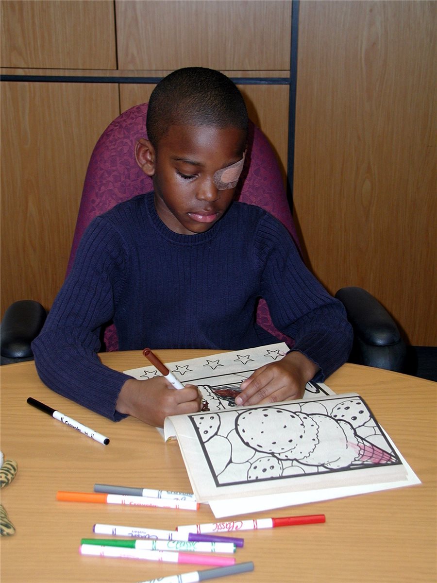 Amblyopia patching therapy: a child wearing an adhesive occlusive eye patch over the stronger eye while colouring, part of standard occlusion treatment for amblyopia