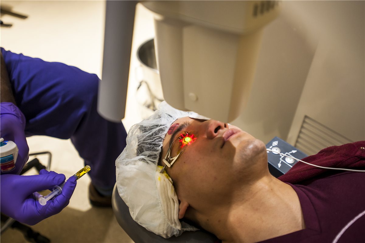 Corneal collagen cross-linking: an intraoperative view of a patient undergoing the procedure, with the riboflavin-soaked cornea fluorescing under ultraviolet light while a speculum holds the lids open