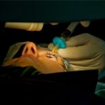 LASIK refractive surgery: a close-up view of a patient undergoing laser-assisted in situ keratomileusis, with a lid speculum in place and the eye positioned under the excimer laser