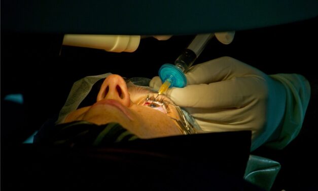 LASIK: What Separates a Good Candidate From a Complicated One