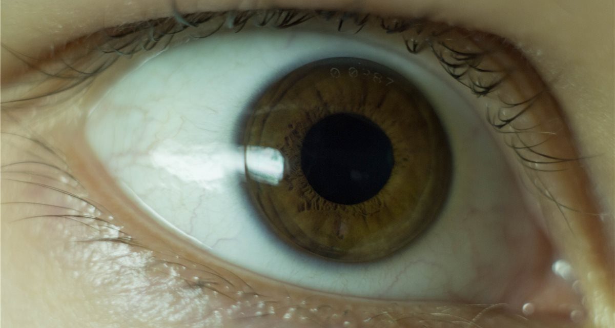 Orthokeratology: A Nighttime Lens Doing Two Jobs at Once