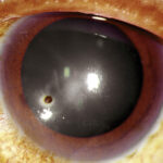 Corneal Foreign Body