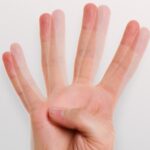 Diplopia