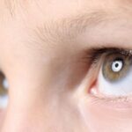 Balint Syndrome