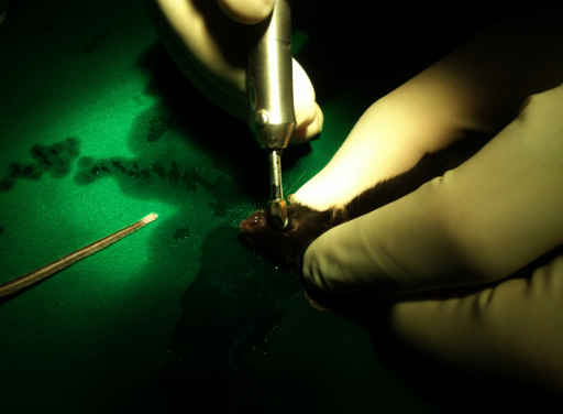 Corneal Endothelial Decompensation: Managing a Layer That Cannot Repair Itself