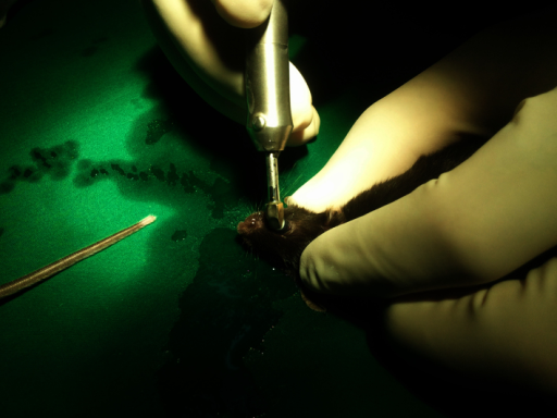 Clinical eye photograph illustrating Corneal Endothelial Decompensation Management