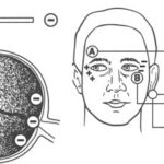 Electrooculography: diagram of the corneoretinal standing potential and electrode placement around the eyes