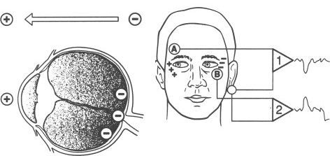 Electrooculography EOG Standing Potential and Electrodes Electrooculography: diagram of the corneoretinal standing potential and electrode placement around the eyes