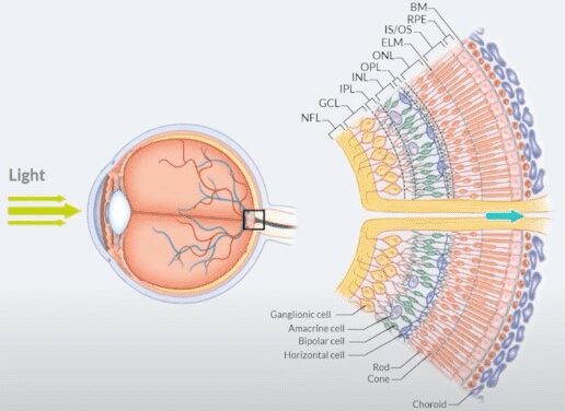 Electroretinography: What the Full-Field ERG Can and Cannot Tell You