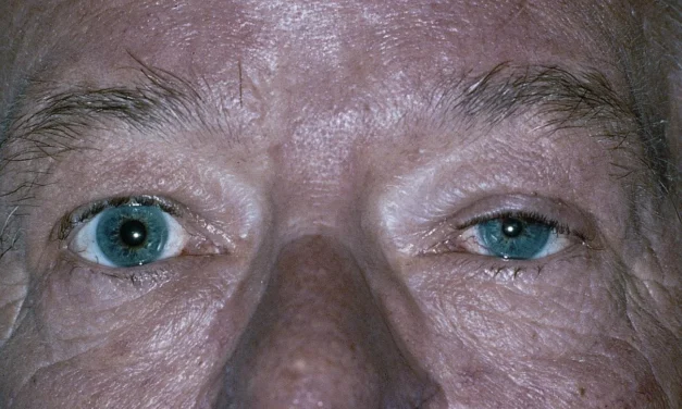 Horner Syndrome: Three Neurons, Three Very Different Emergencies