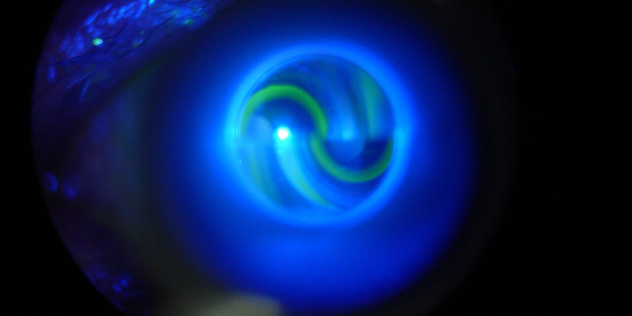 Ocular Hypertension: Elevated Pressure That Isn’t Glaucoma Yet