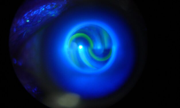 Ocular Hypertension: Elevated Pressure That Isn’t Glaucoma Yet