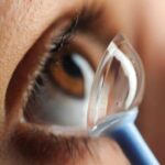 Scleral Contact Lens Fitting: clinical photograph
