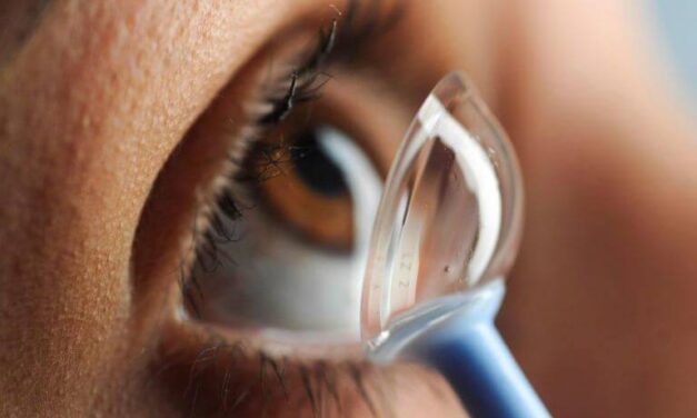 Scleral Contact Lens Fitting: Vaulting the Cornea to Restore Vision