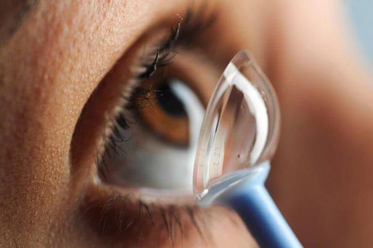 Scleral Contact Lens Fitting: Vaulting the Cornea to Restore Vision
