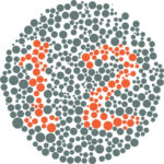 Clinical image illustrating Color Vision Deficiency