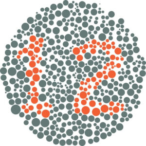 Clinical image illustrating Color Vision Deficiency