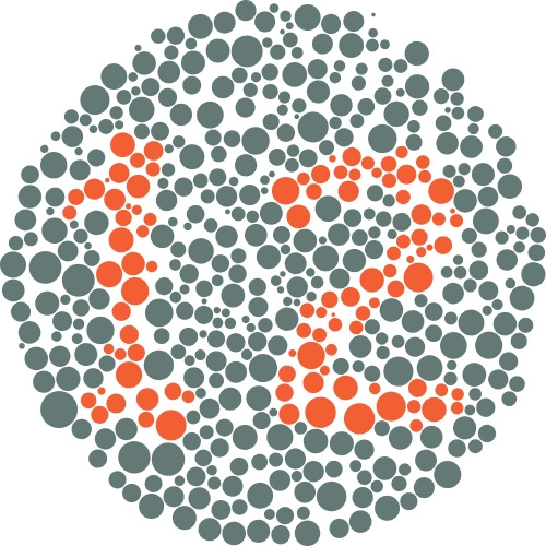 Clinical image illustrating Color Vision Deficiency
