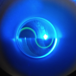 Clinical image illustrating IOP Measurement