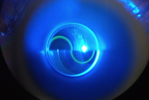 Clinical image illustrating IOP Measurement
