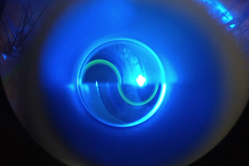 Clinical image illustrating IOP Measurement