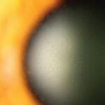 Clinical eye photograph illustrating Lisch Epithelial Corneal Dystrophy