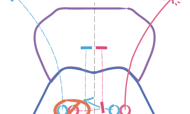 One-and-a-Half Syndrome: Localizing a Single Brainstem Lesion From the Eye Movements Alone