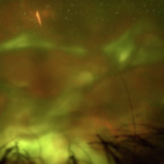 Clinical eye photograph illustrating Phacoanaphylactic Endophthalmitis